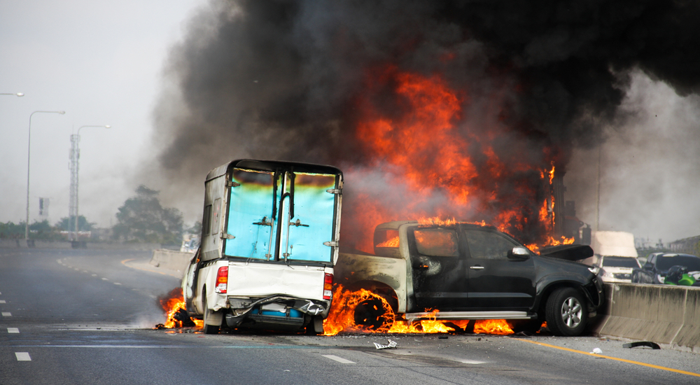 New York Burn Injury Lawyers | Call (631) 465-9797